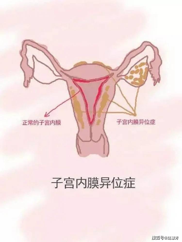 b超子宫大小正常范围