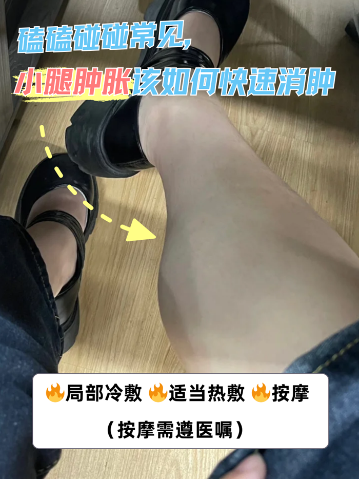 腿肿怎么快速消肿