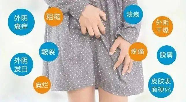 外阴红肿疼痛怎么办
