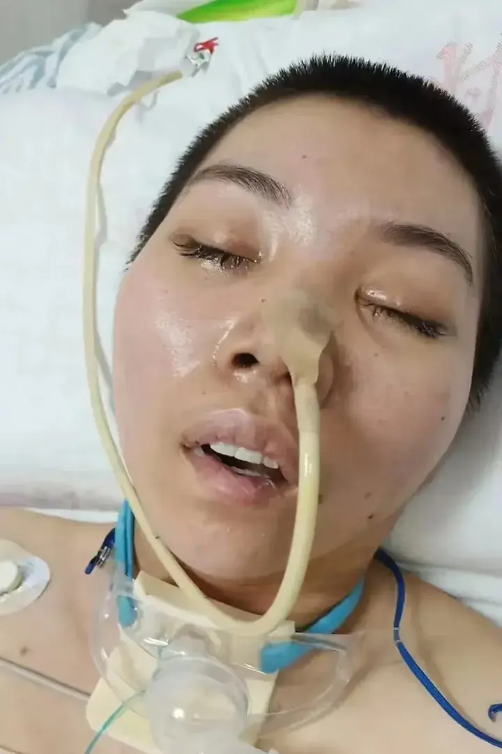 赫依病是什么病