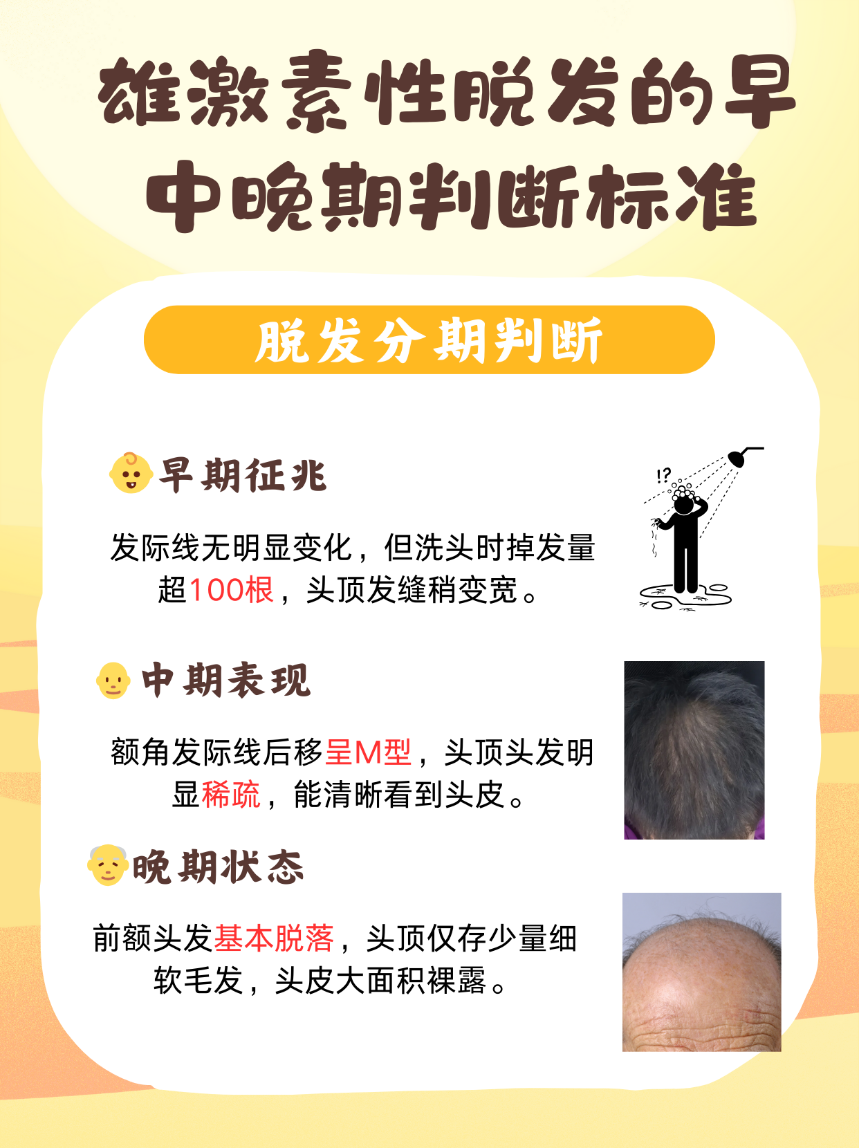 严重脱发是怎么回事