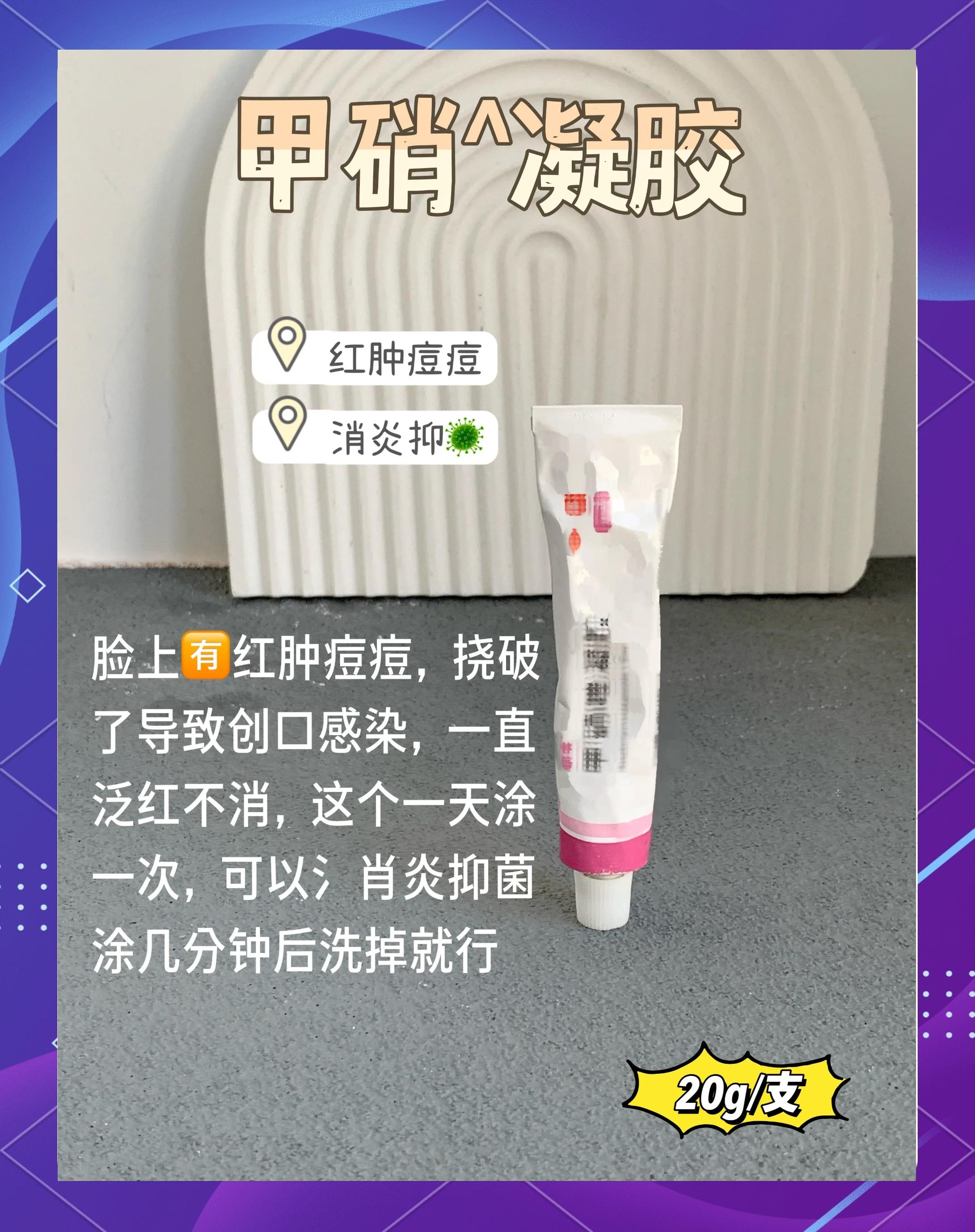 痤疮用什么药膏最有效