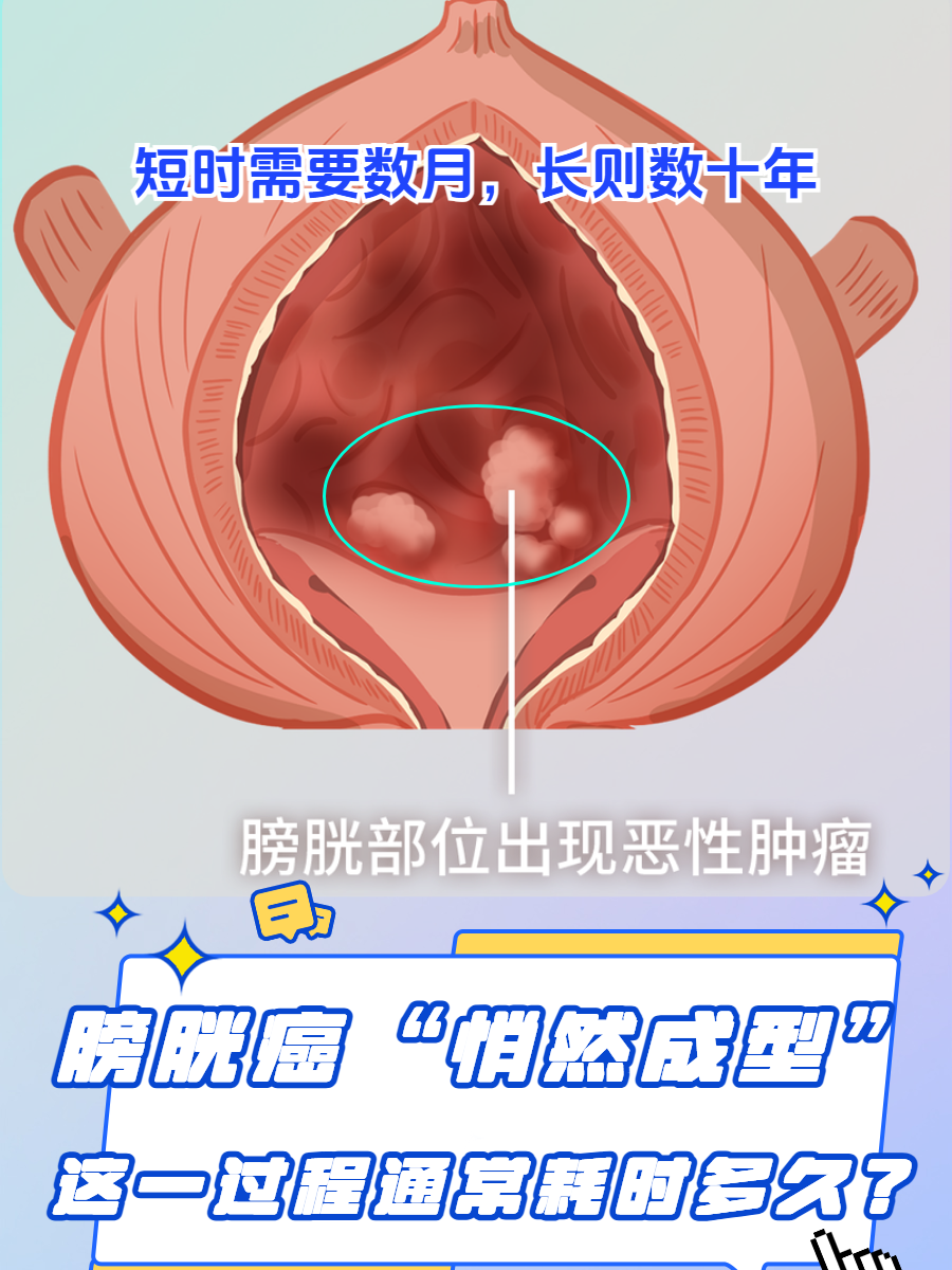 肿瘤是怎么形成?