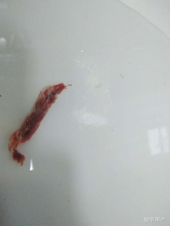 来月经排出像烂肉一样的东西是什么