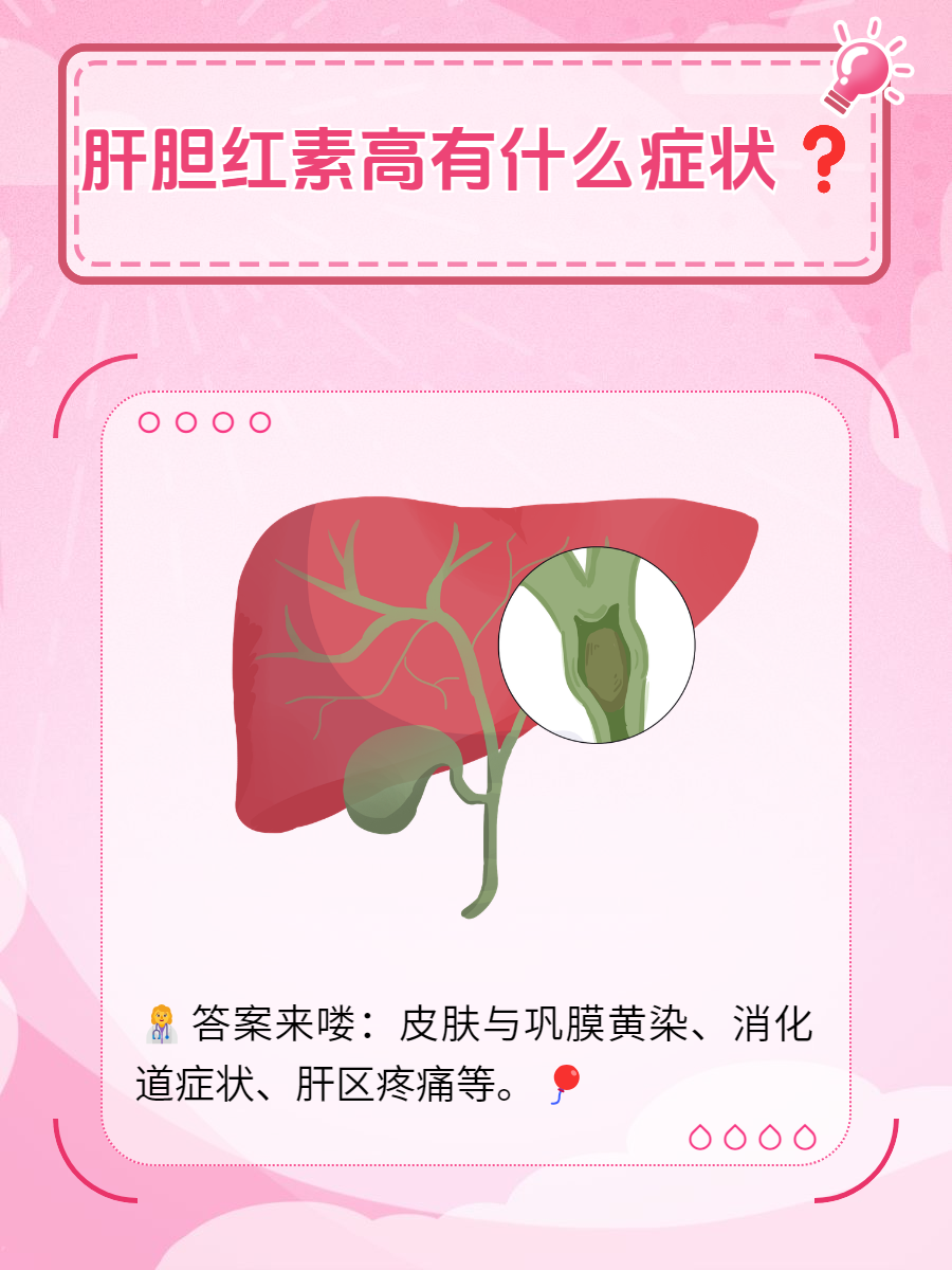什么是胆红素