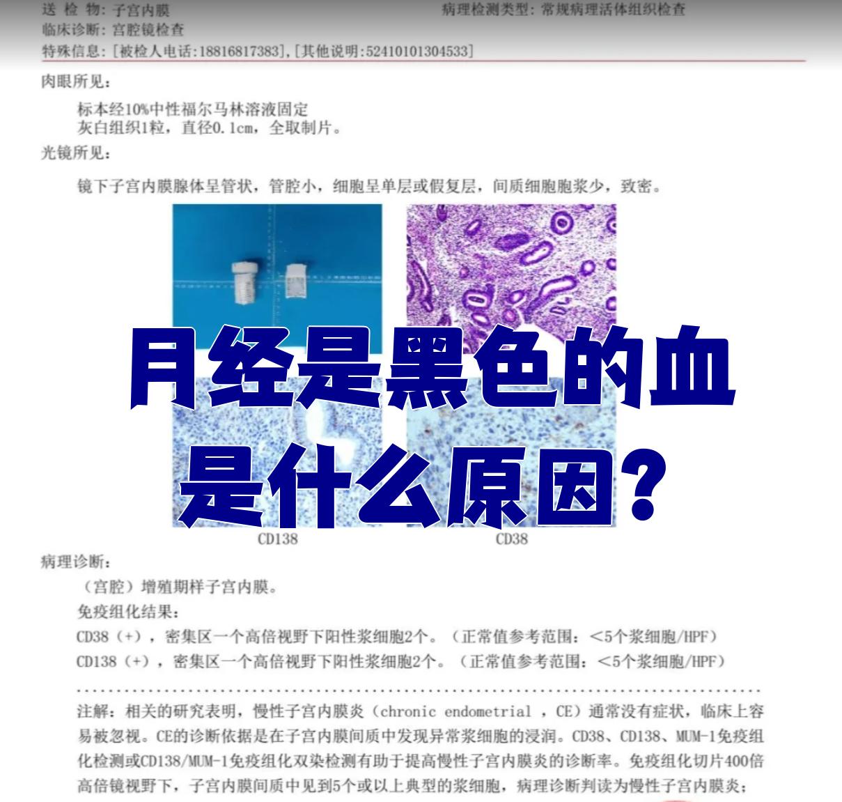 经血发黑是什么原因啊?