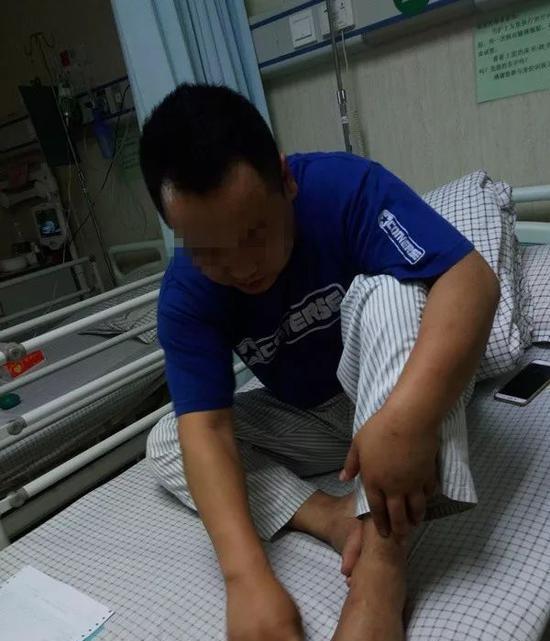 我星期六去钓鱼,结果左腰那里有可能被蚂蚁咬了