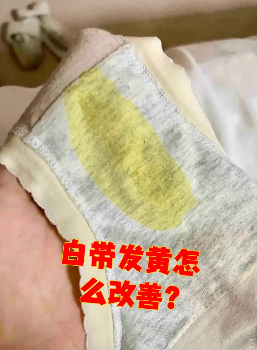 白带发黄,粘稠,是什么原因