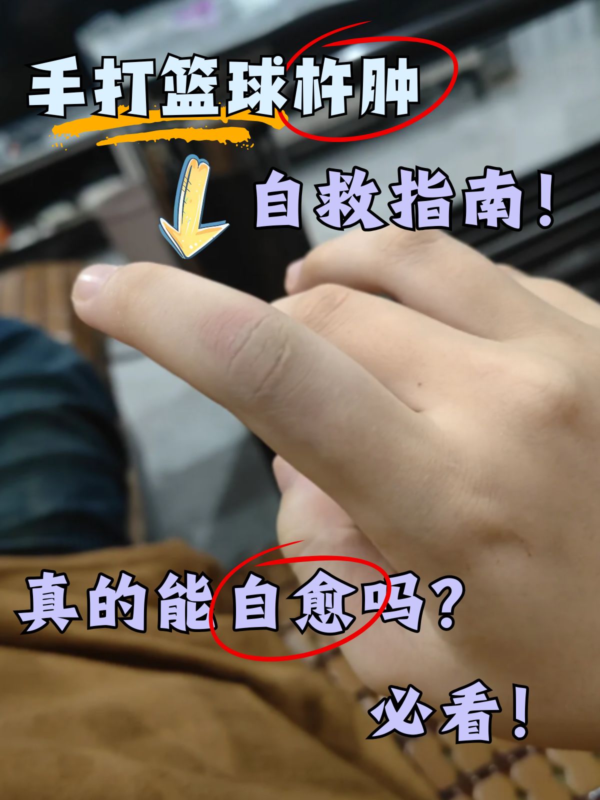 手指肿了怎么快速消肿