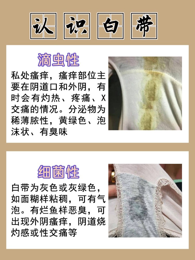白带一般什么时候会有?