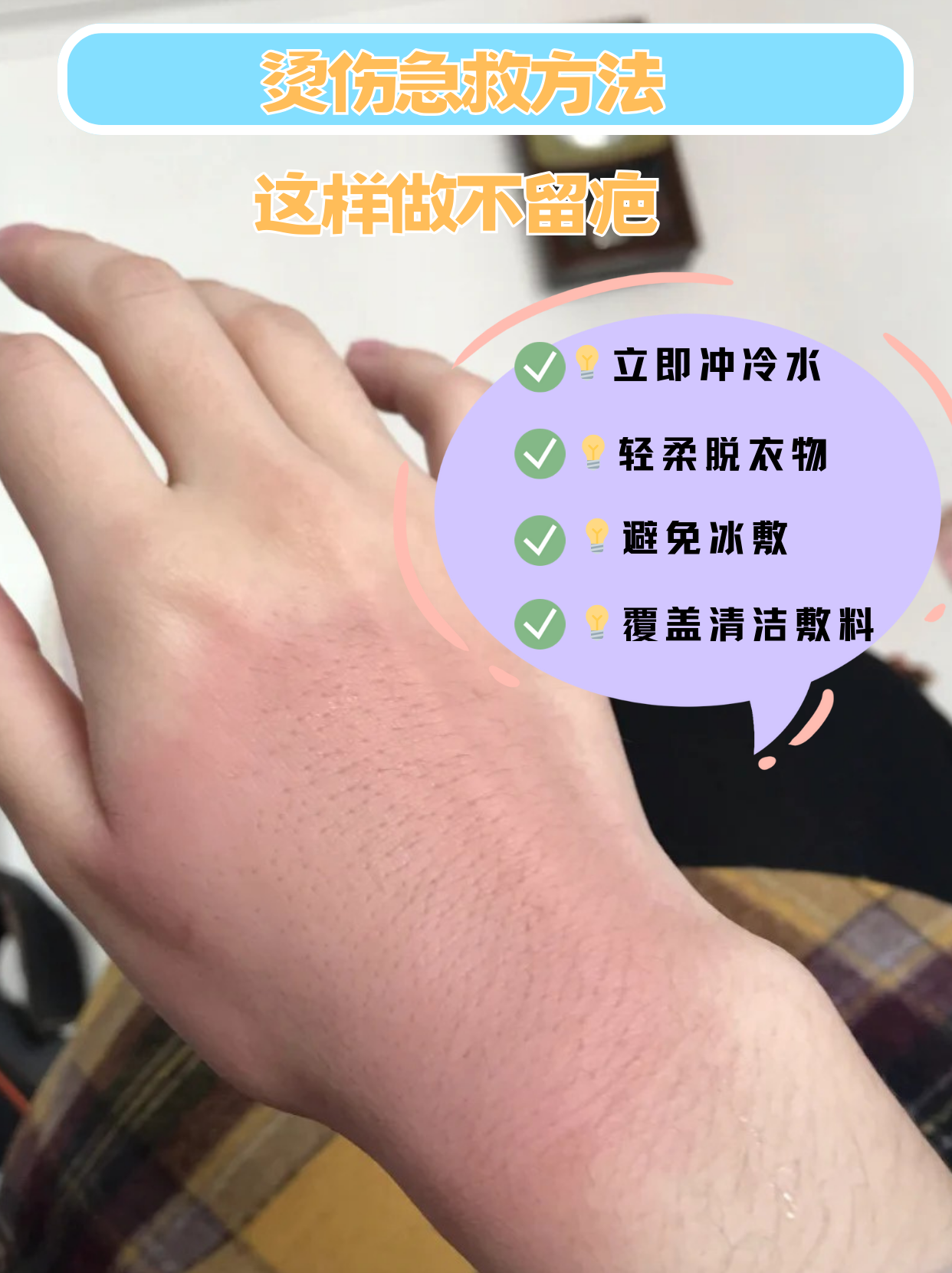 手被烫伤了怎么办?