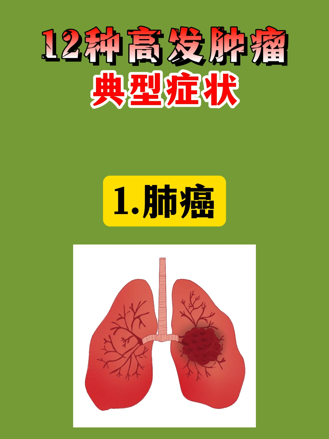 癌症的主要症状是什么?