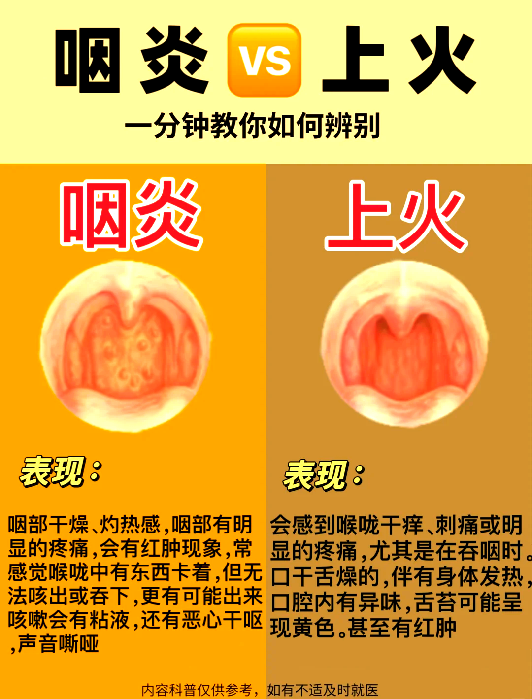 上火嗓子疼怎么治疗
