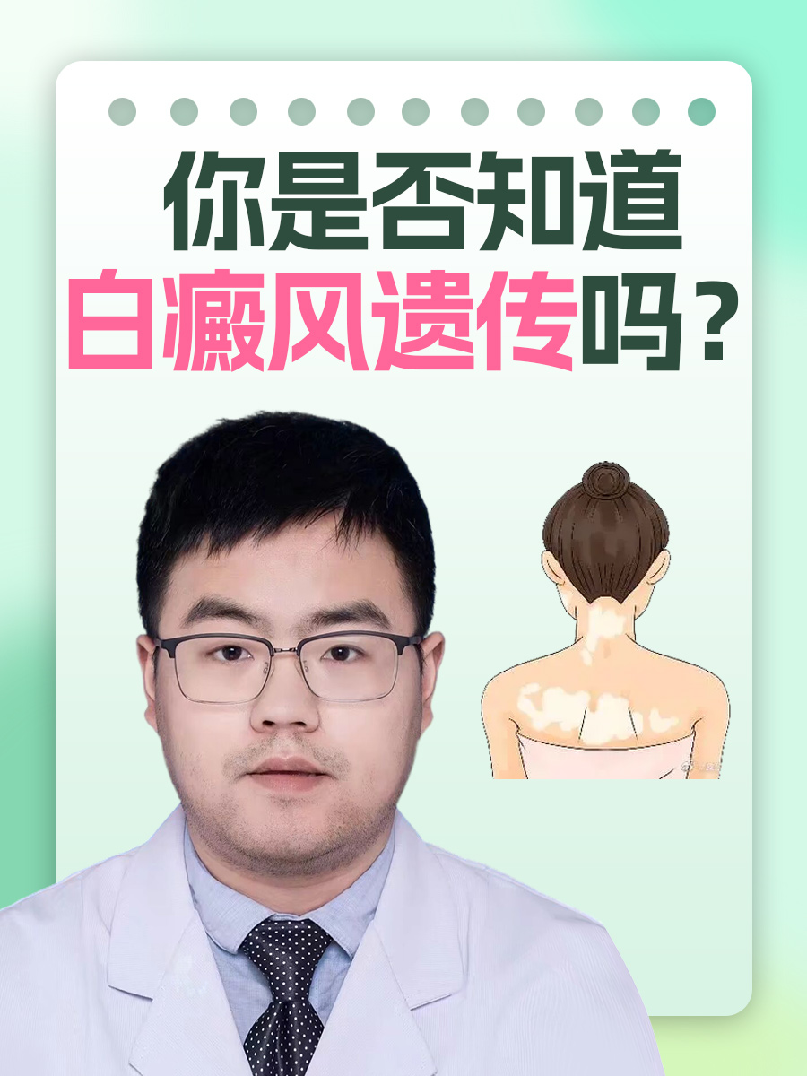 什么是白癜风?