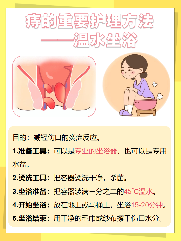 内痔需要手术吗?