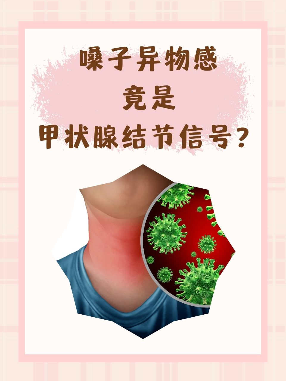 喉咙有异物感怎么消除