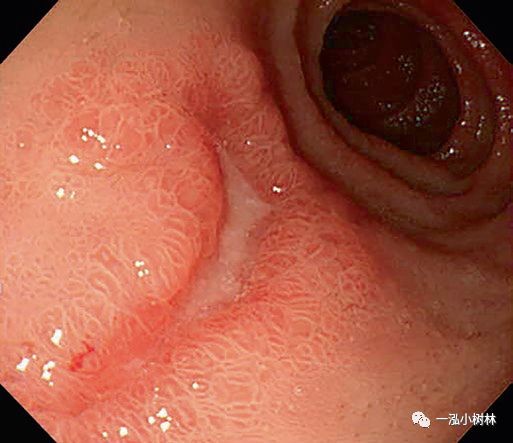 鲜于暄和 第2页