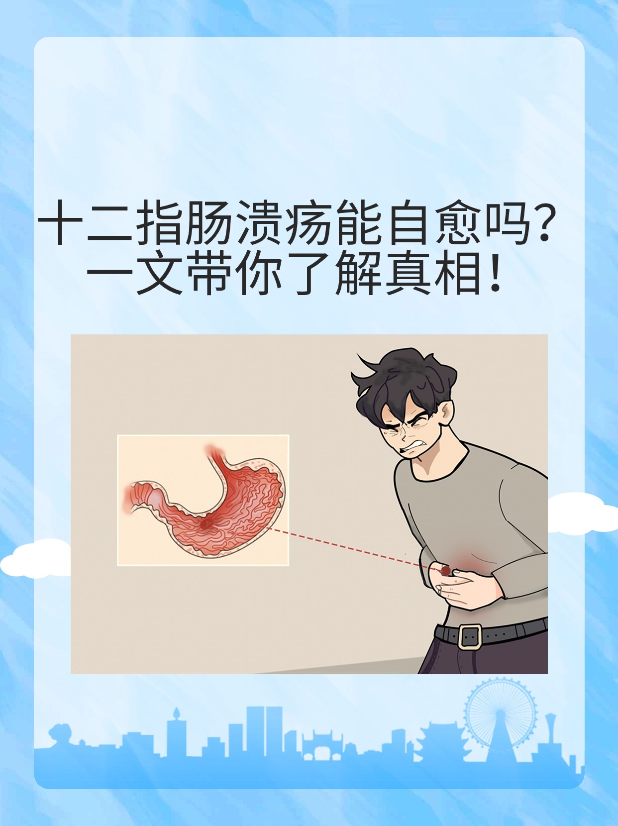 什么是十二指肠球部溃疡?