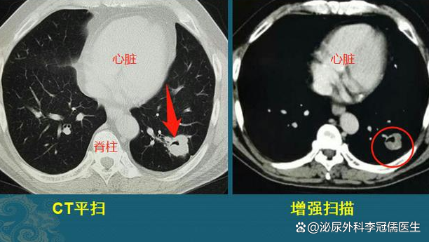 CT对身体有害吗