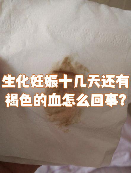 流产后流几天血