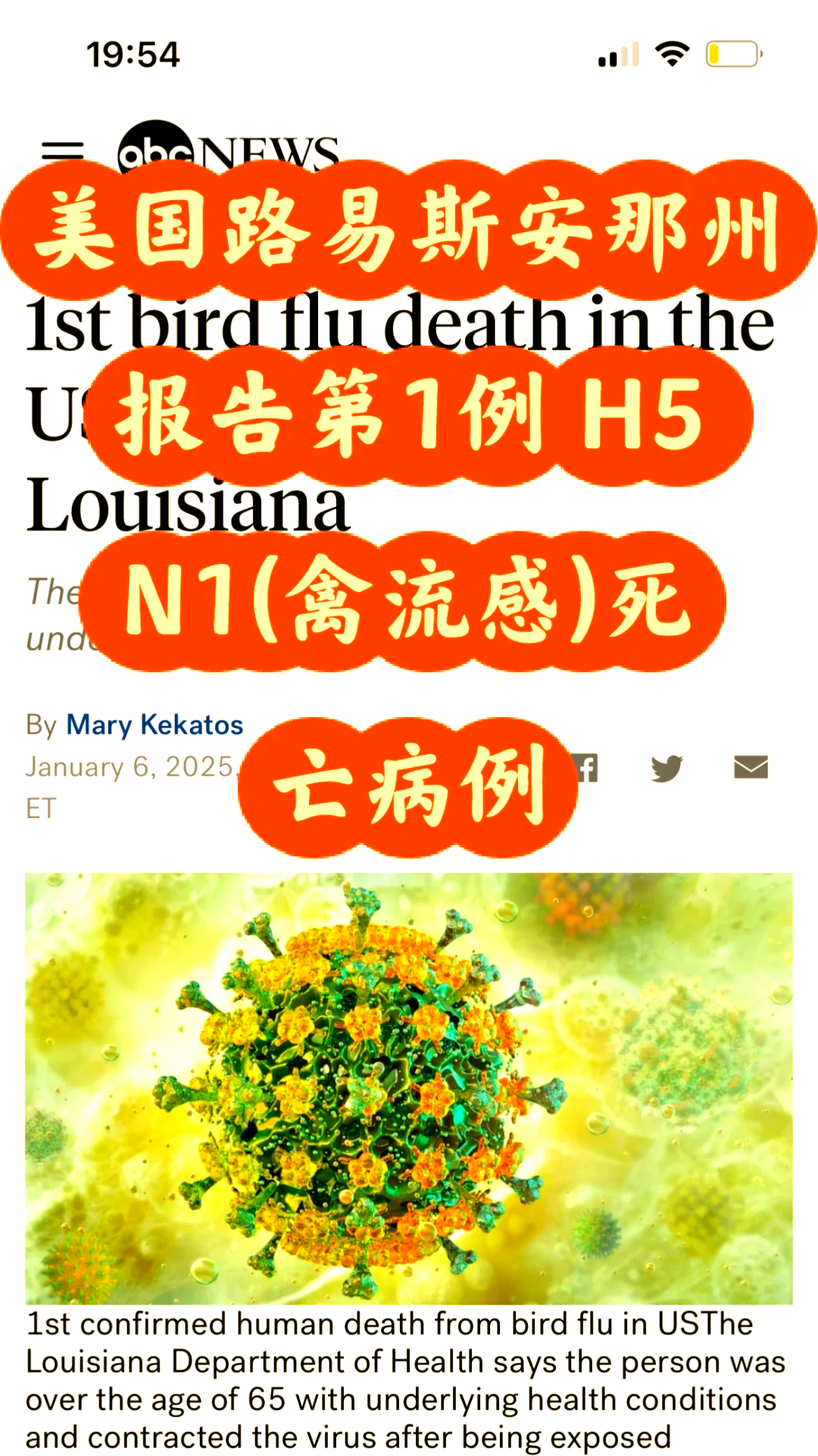 人得禽流感什么症状
