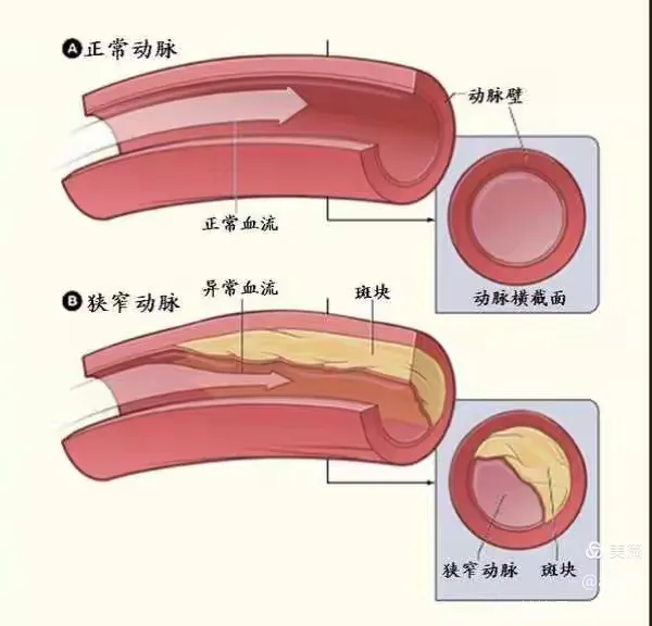 心脏间歇性停跳危险吗