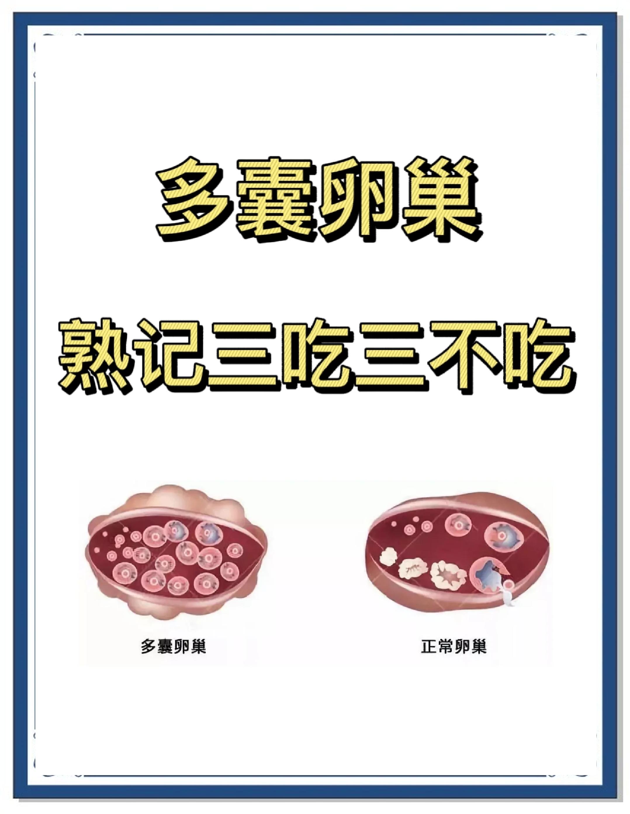 怎么治疗多囊卵巢