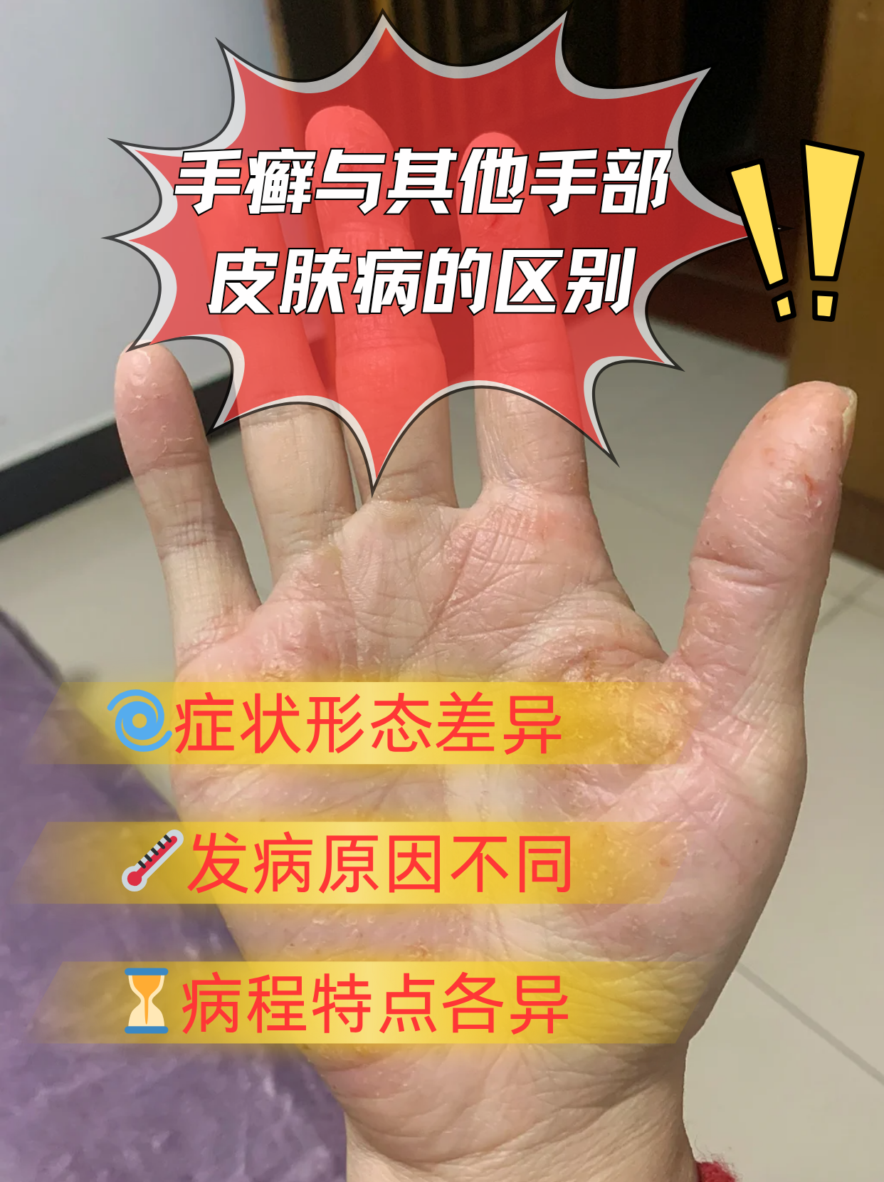 手上起了很多小疙瘩是怎么回事