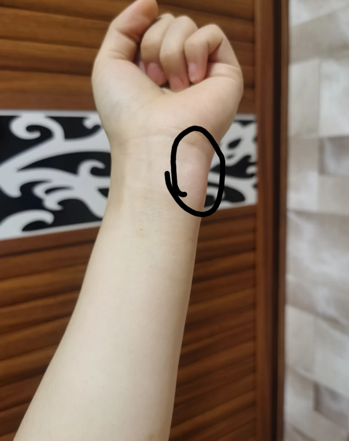 手腕扭伤多久能好