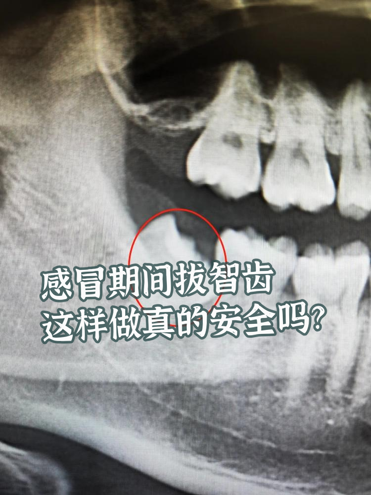 智齿还没有长出来可以拔吗