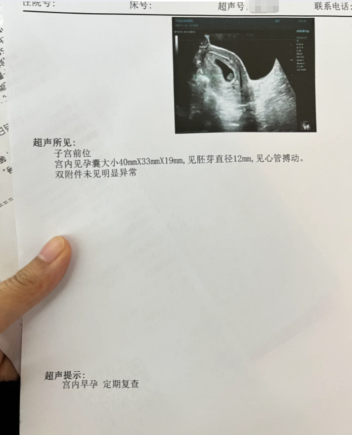 怀孕第一个月吃药,对胎儿有影响吗?