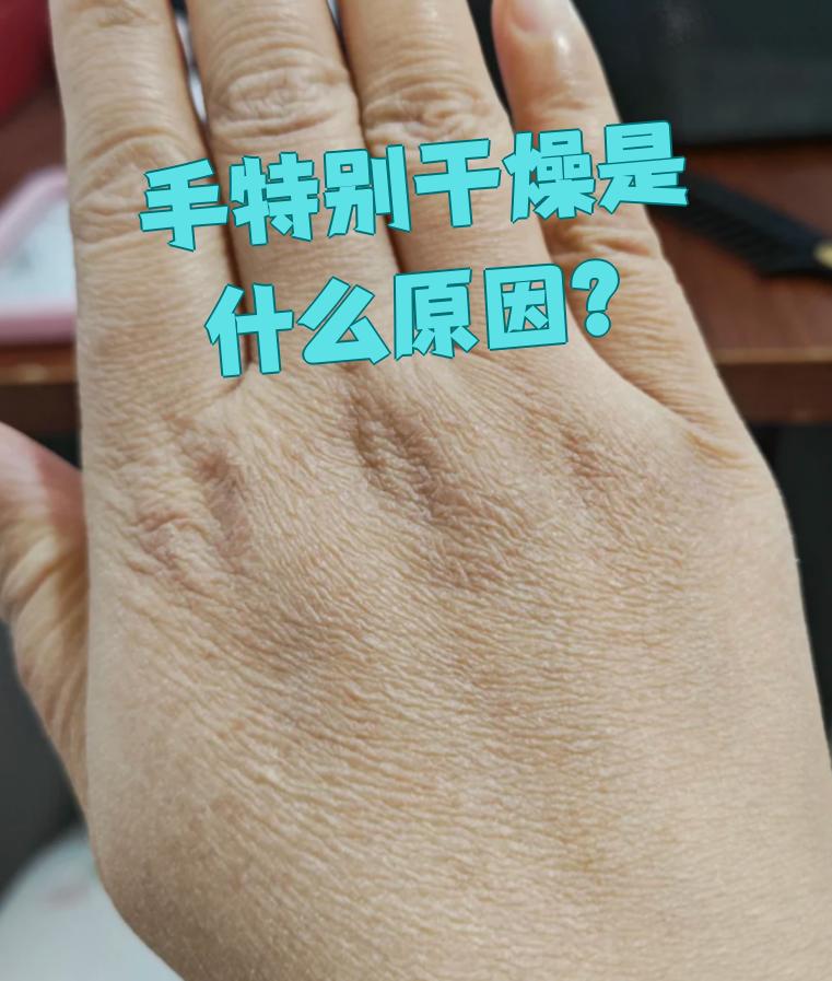 手皮肤特别干燥粗糙怎么办