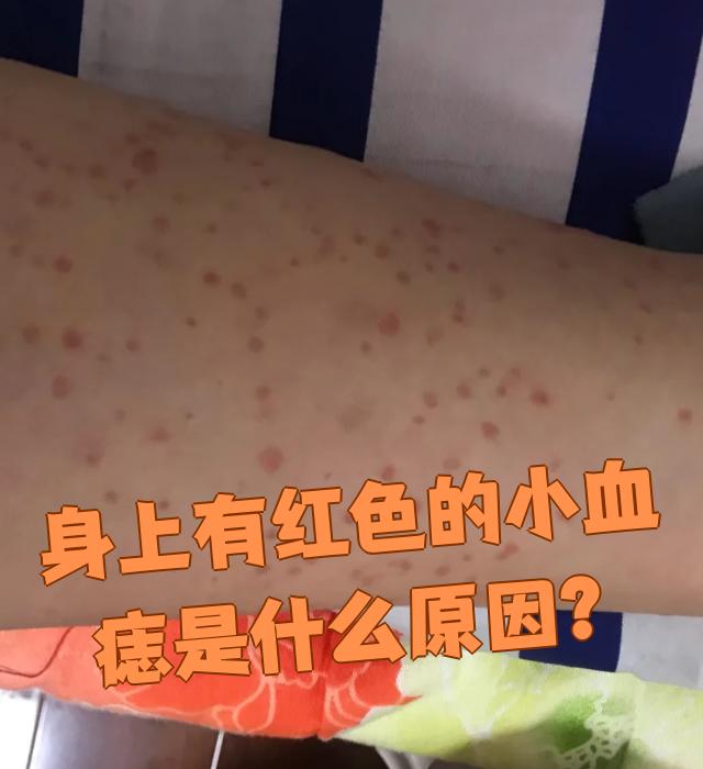 身上长了很多红痣怎么办?
