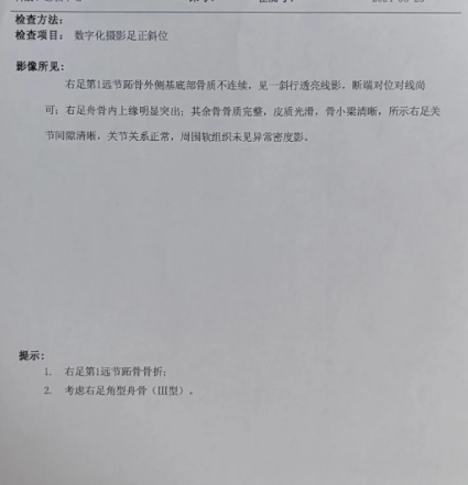 骨头错位多少天可以好