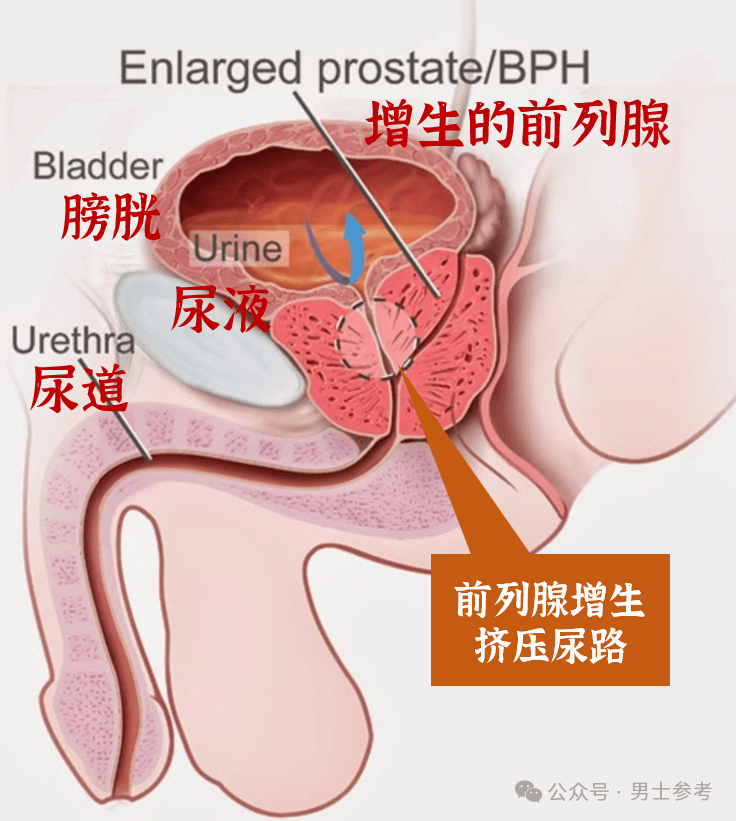 什么是前列腺?