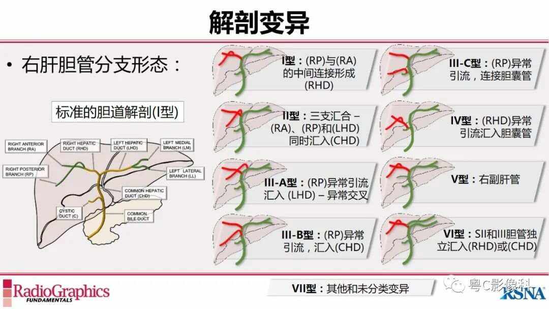 mrcp是什么检查