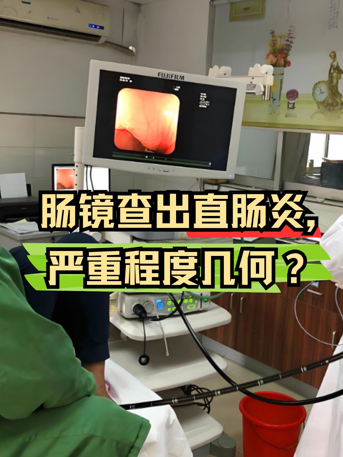 直肠炎最佳治疗方法是什么?