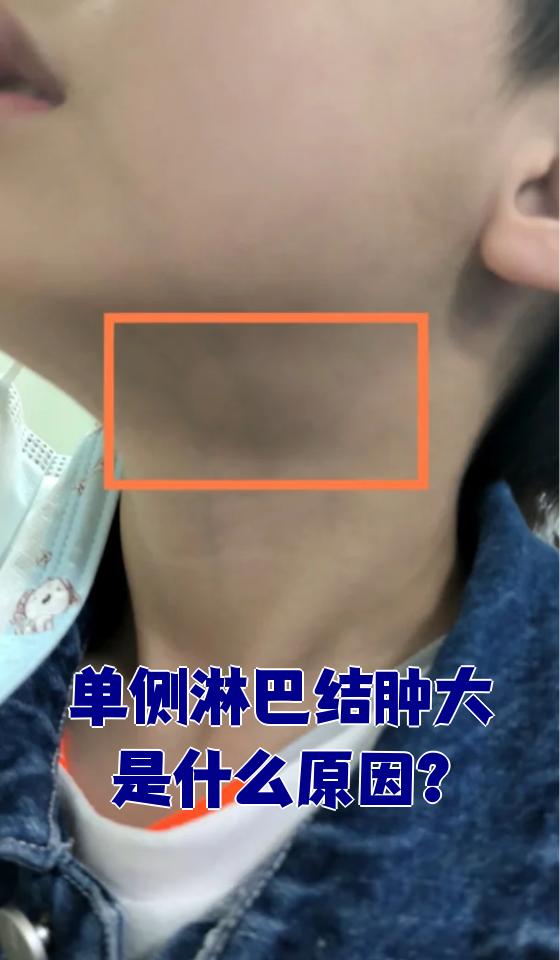 淋巴结肿大症状