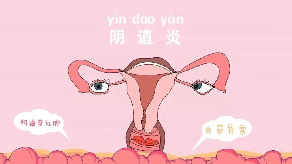 细菌性阴炎什么症状