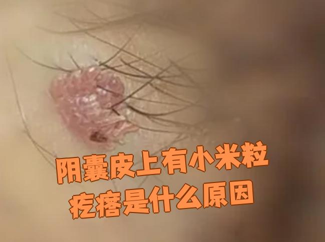 阴囊上长疙瘩是怎么回事?