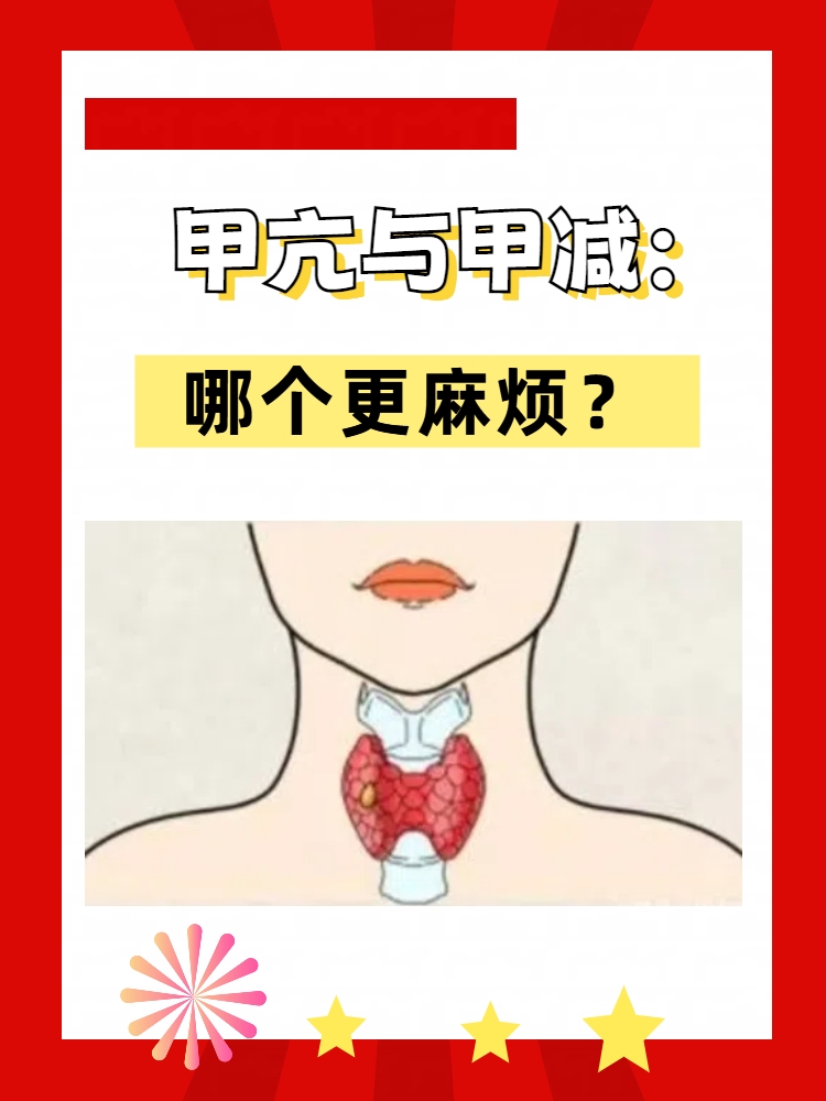 甲状腺激素高的症状