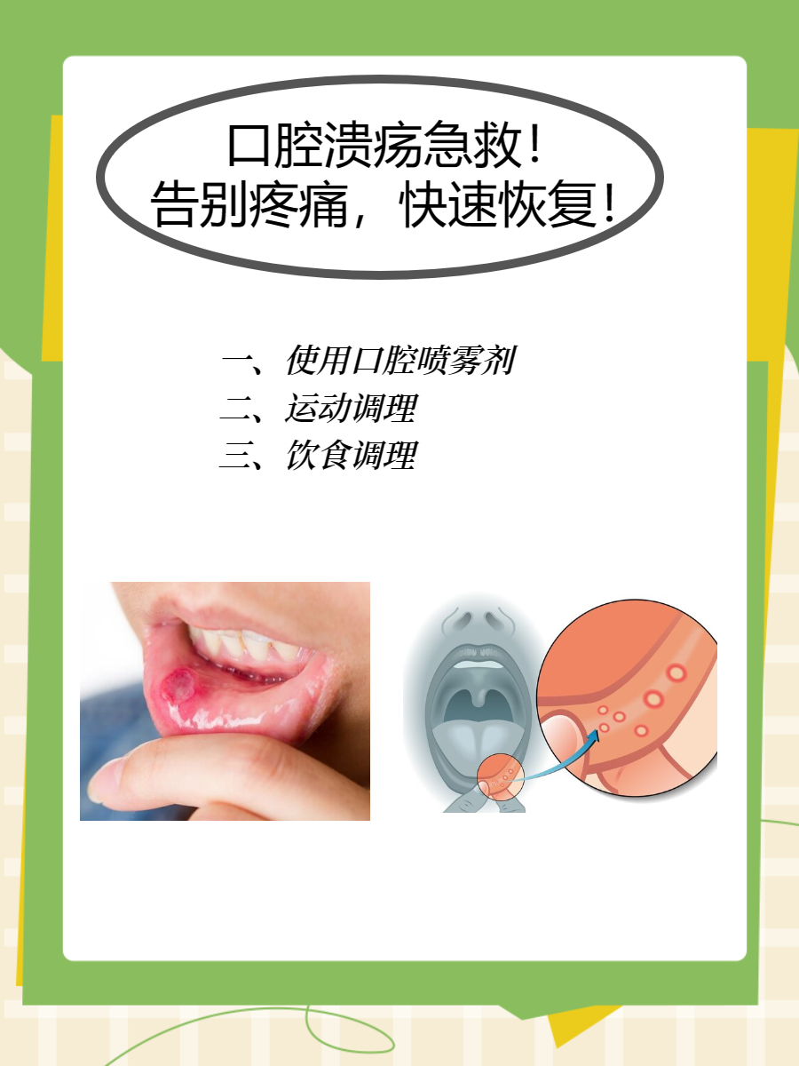 宝宝口腔溃疡怎么办