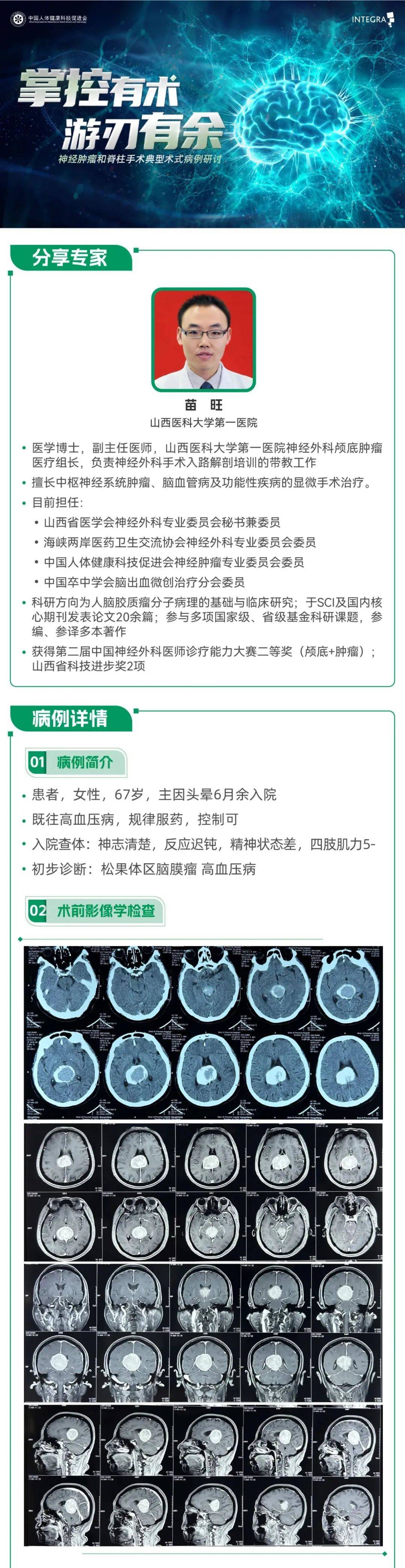 脑膜瘤手术后能活多久