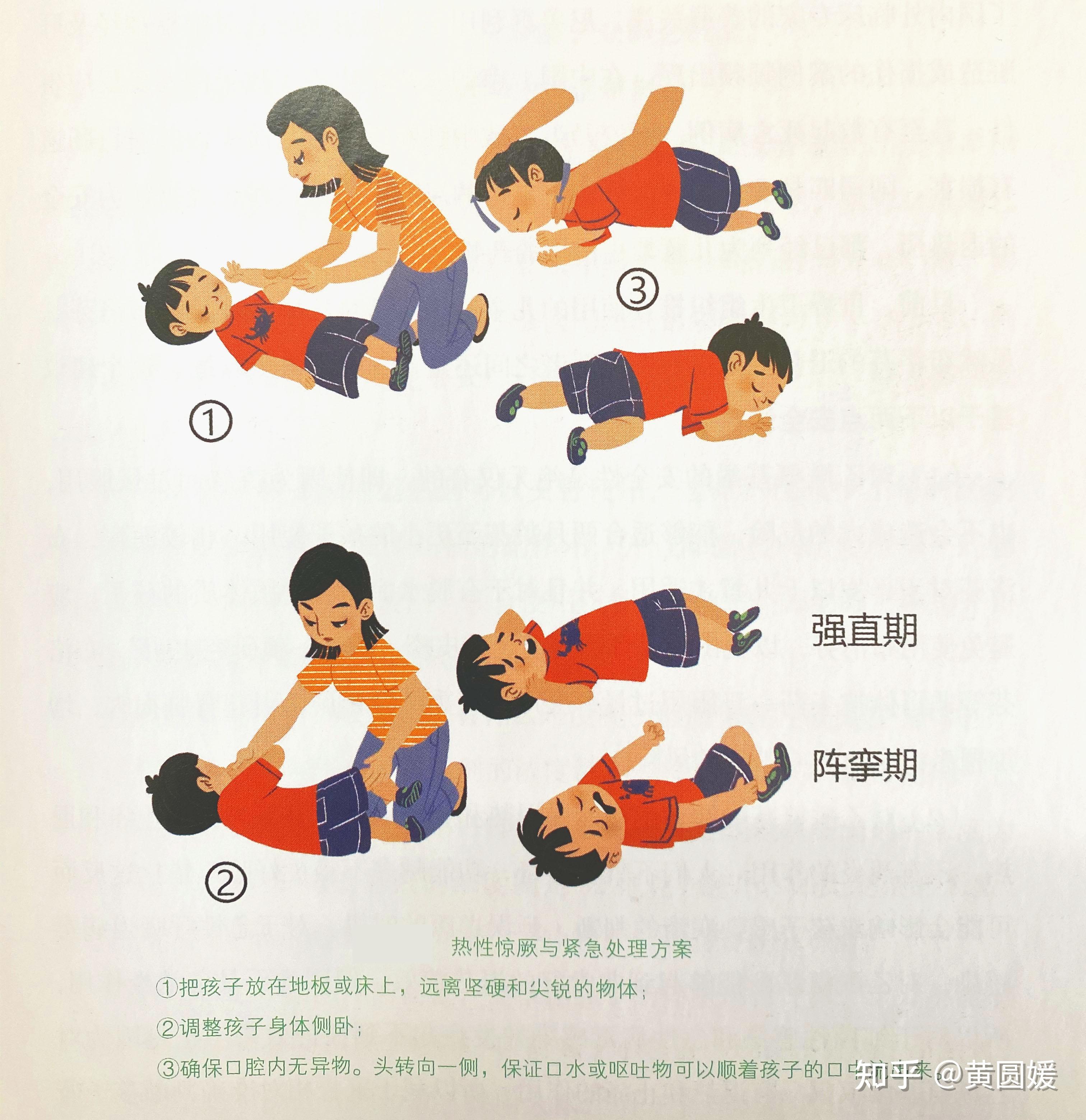 小儿惊厥的症状有哪些?