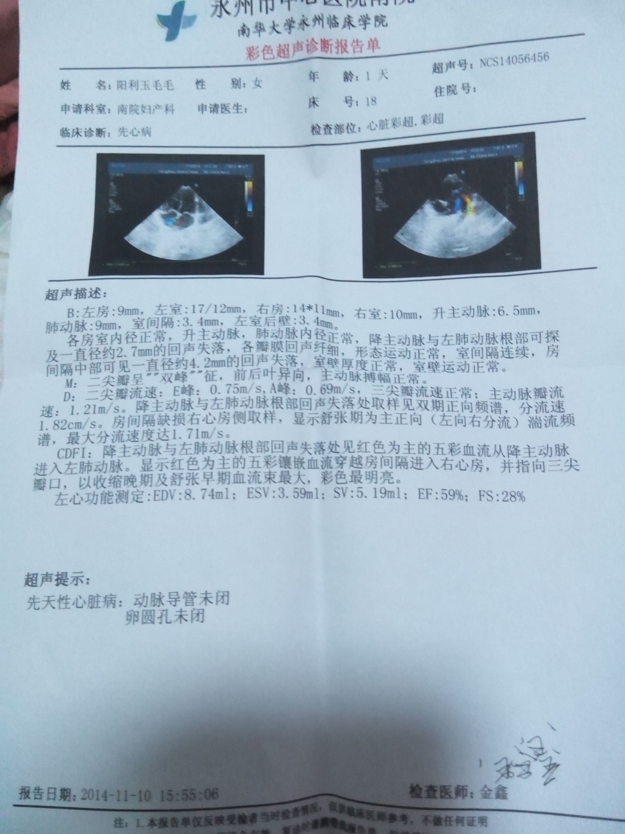 动脉导管未闭严重吗