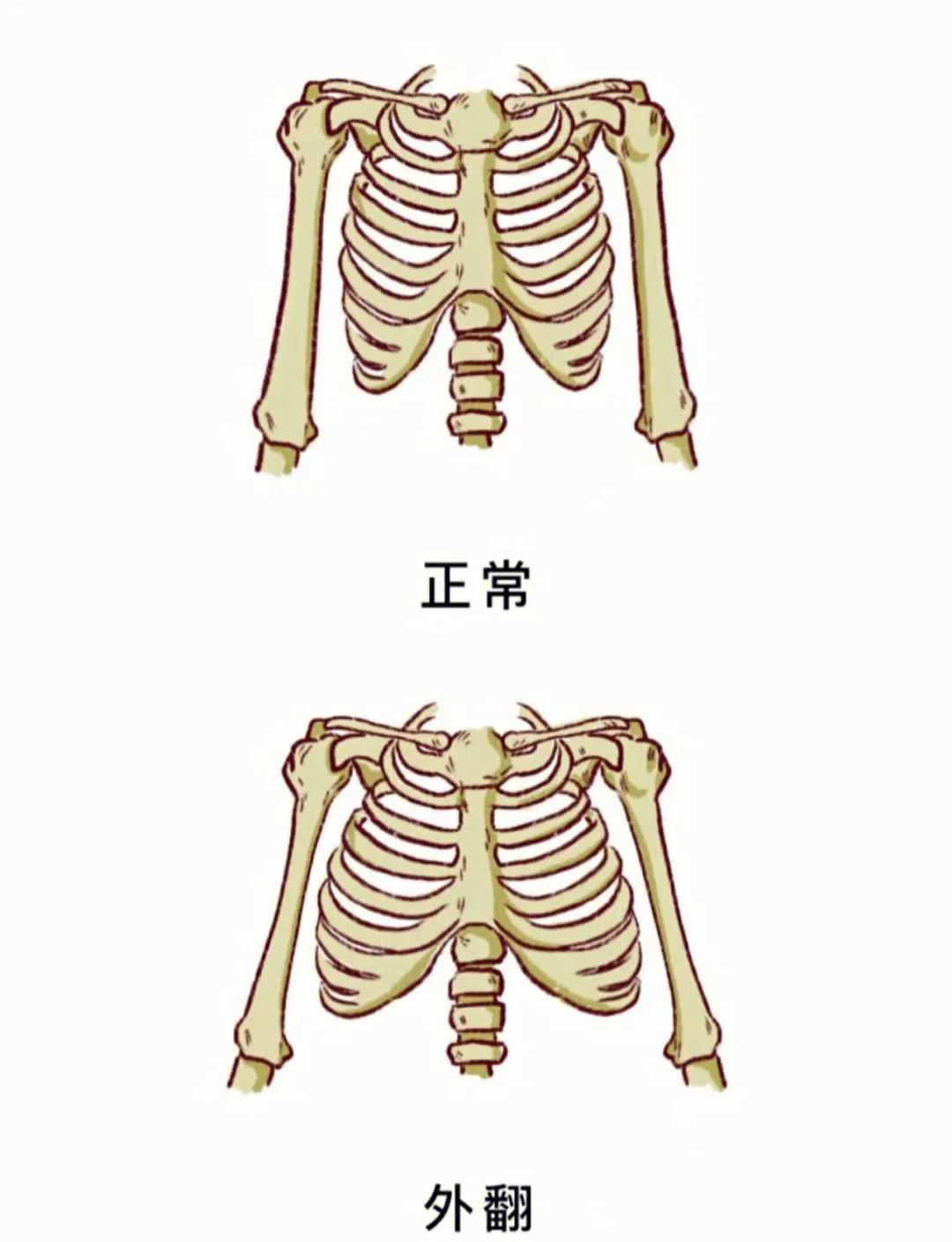 婴儿肋骨外翻的原因有哪些