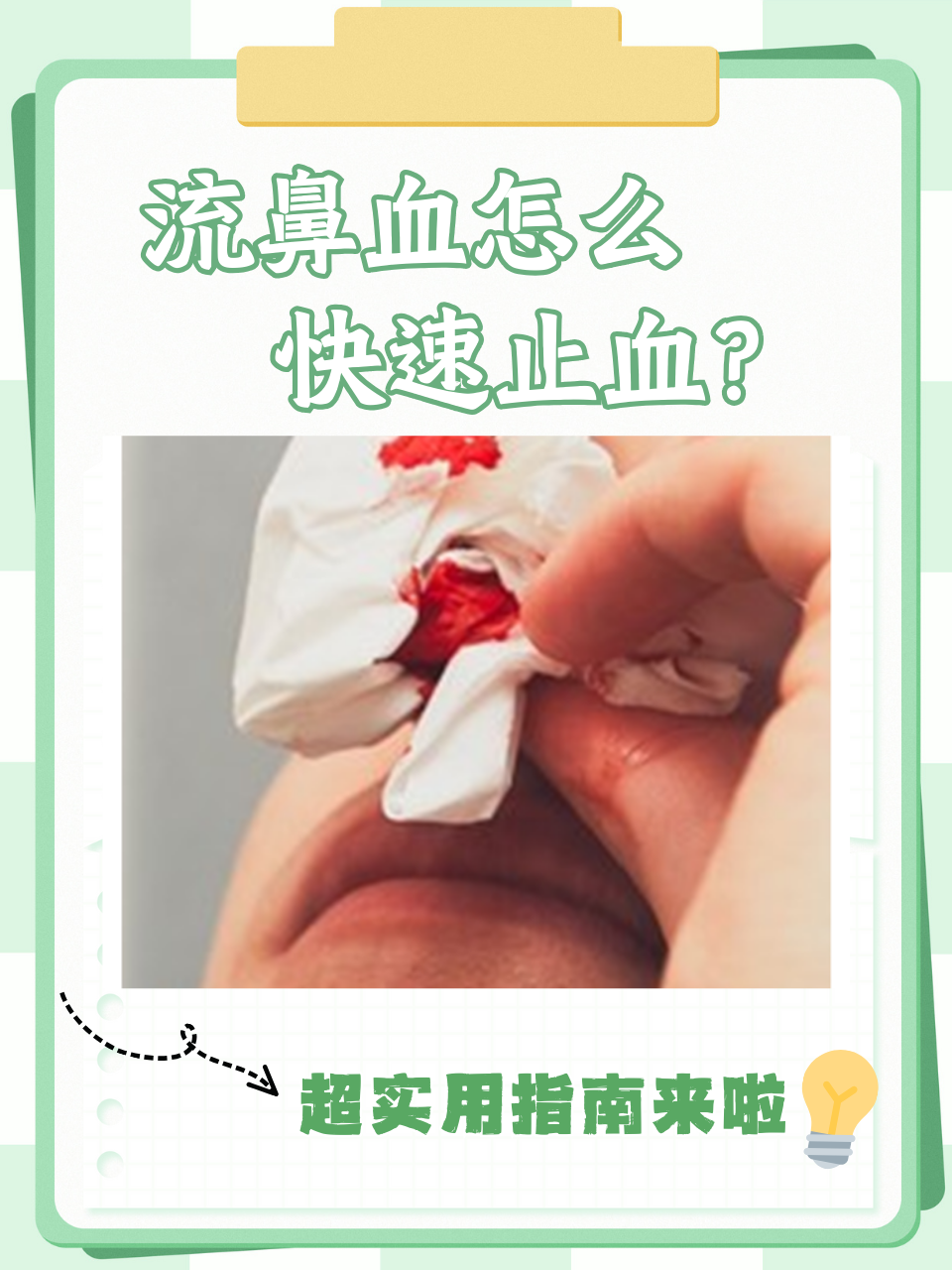老流鼻血怎么治疗?