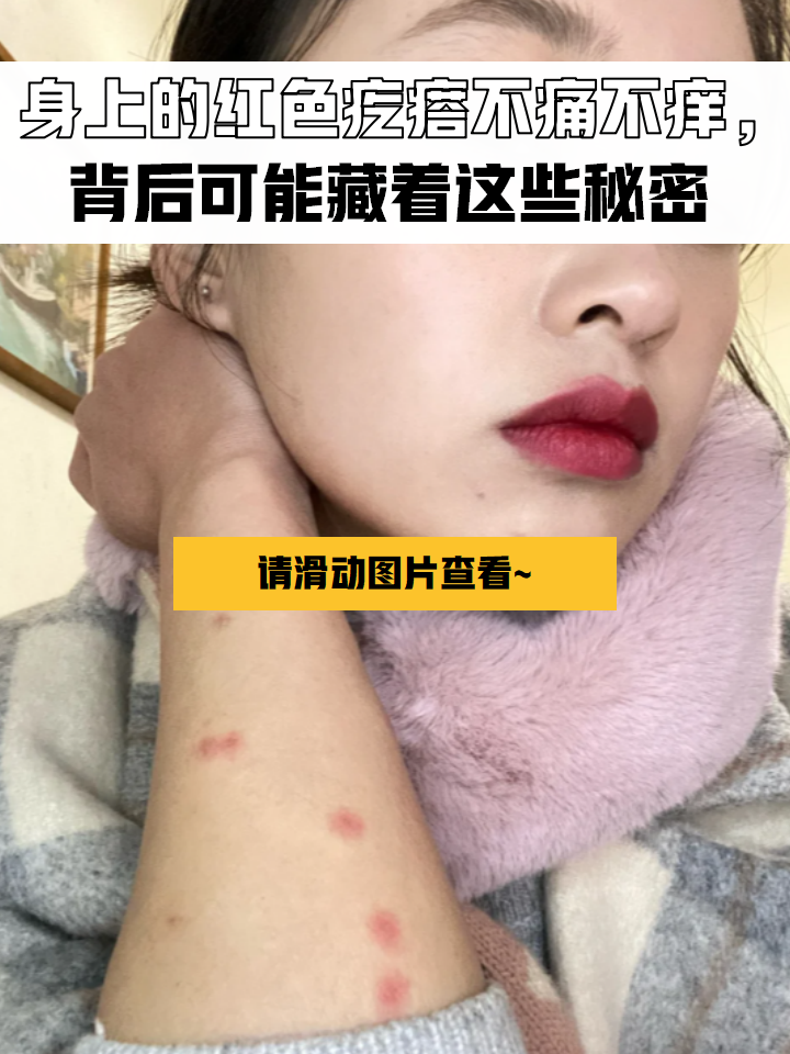 身上长红疙瘩,不痛不痒是什么?