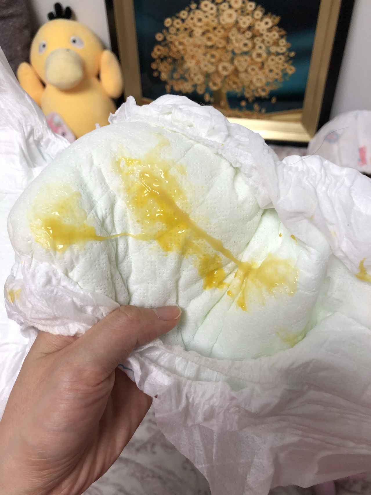 大便的头上有些粘液,前面大便有点干