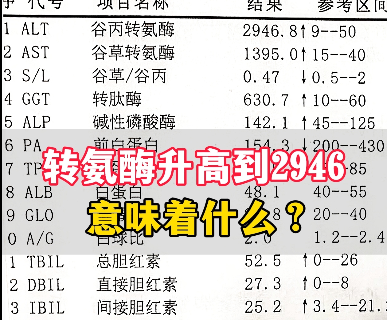 血清丙氨酸氨基转移酶值偏高